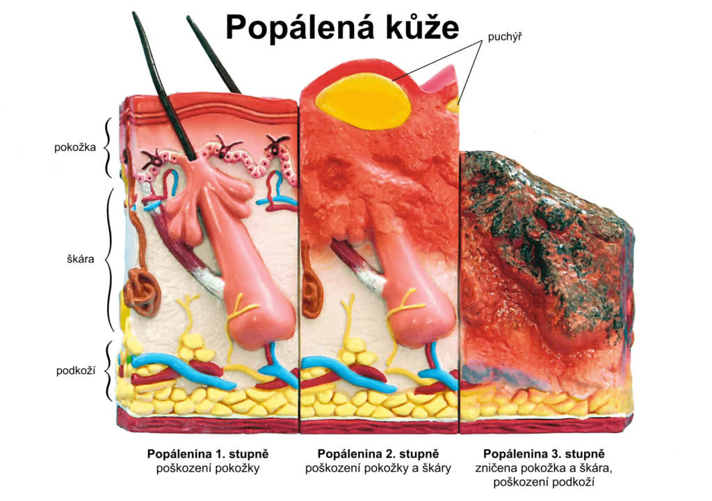 popalena kuze A5 1